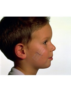 CEROTTO PER SUTURA NEXCARE STERISTRIP 6X75 MM + 3X75 MM 2
