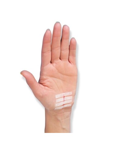 CEROTTO PER SUTURA NEXCARE STERISTRIP 6X75 MM + 3X75 MM