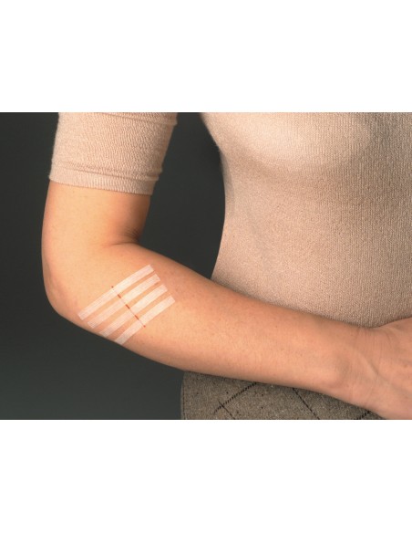 CEROTTO PER SUTURA NEXCARE STERISTRIP 6X75 MM + 3X75 MM