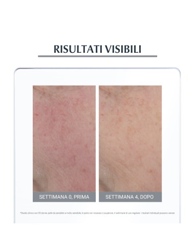 EUCERIN ANTIROSE TRATTAMENTO LENITIVO NOTTE 50ML