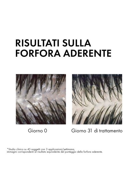 DERCOS SHAMPO ANTIFORFORA GRASSI 200 ML