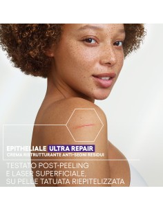 EPITHELIALE ULTRA REPAIR CREMA RISTRUTTURANTE ANTI SEGNI RESIDUI 100 ML 2