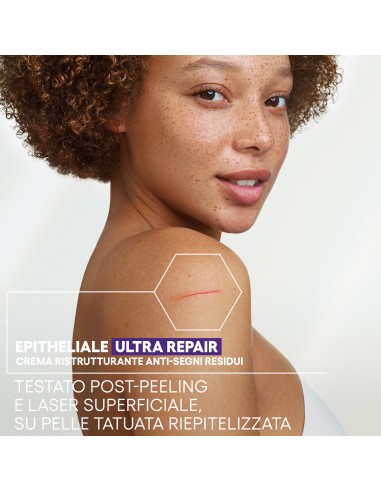 EPITHELIALE ULTRA REPAIR CREMA RISTRUTTURANTE ANTI SEGNI RESIDUI 100 ML