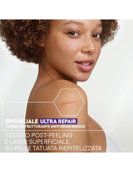 EPITHELIALE ULTRA REPAIR CREMA RISTRUTTURANTE ANTI SEGNI RESIDUI 100 ML