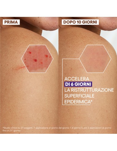 EPITHELIALE ULTRA REPAIR CREMA RISTRUTTURANTE ANTI SEGNI RESIDUI 100 ML