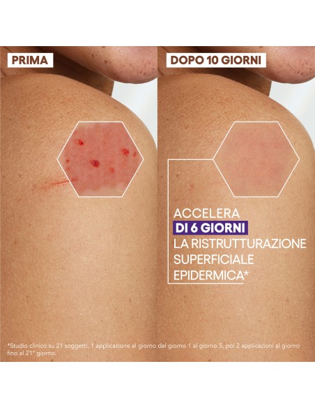 EPITHELIALE ULTRA REPAIR CREMA RISTRUTTURANTE ANTI SEGNI RESIDUI 100 ML