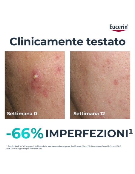 EUCERIN DERMOPURE CLINICAL SIERO TRIPLA AZIONE 40 ML
