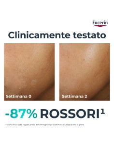 EUCERIN DERMOPURE CLINICAL TRATTAMENTO LENITIVO 40 ML 2