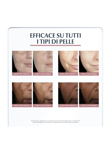 EUCERIN ANTI-PIGMENT DUAL SERUM ANTI-MACCHIE 30 ML
