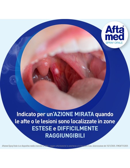 AFTAMED SPRAY FLACONE 20 ML