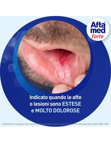 AFTAMED GEL FORTE SCUDO 8 ML
