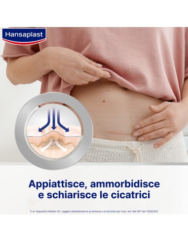 CEROTTO RIDUZIONE CICATRICI HANSAPLAST MED 21 PEZZI